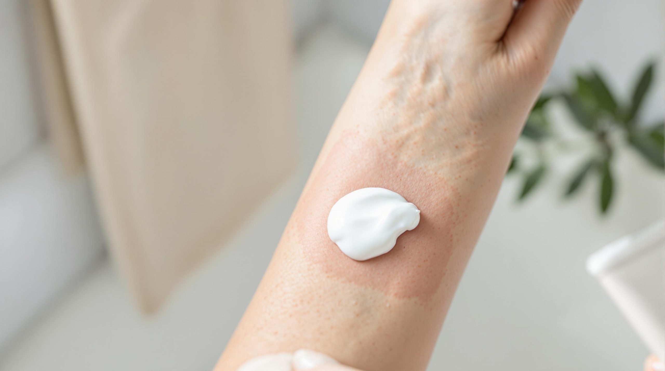 Quelle est la meilleure crème pour l’eczéma ?